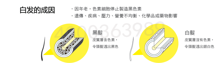 白發(fā)的成因